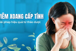 Viêm xoang cấp tính – giải pháp hiệu quả từ thảo dược