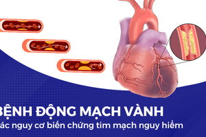 Bệnh động mạch vành và các nguy cơ biến chứng tim mạch nguy hiểm