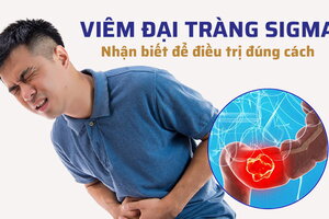 Viêm đại tràng sigma: Nhận biết để điều trị đúng cách