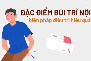 Đặc điểm búi trĩ nội và các biện pháp điều trị hiệu quả