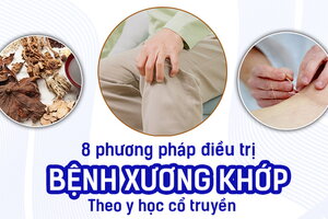 8 phương pháp điều trị bệnh xương khớp theo y học cổ truyền