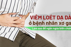 Viêm loét dạ dày ở bệnh nhân xơ gan: làm sao để ngăn ngừa biến chứng?