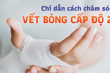 Chỉ dẫn cách chăm sóc vết bỏng cấp độ 2 tại nhà