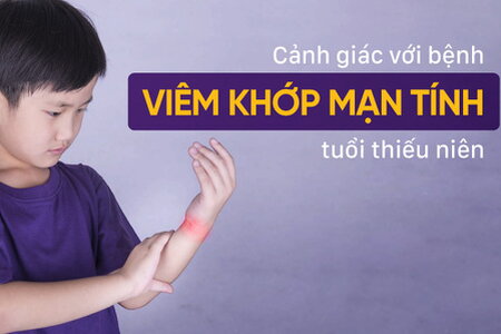 Cảnh giác với bệnh viêm khớp mạn tính tuổi thiếu niên