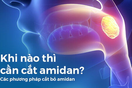 Khi nào thì cần cắt amidan? Cách phương pháp cắt bỏ amidan hiện nay