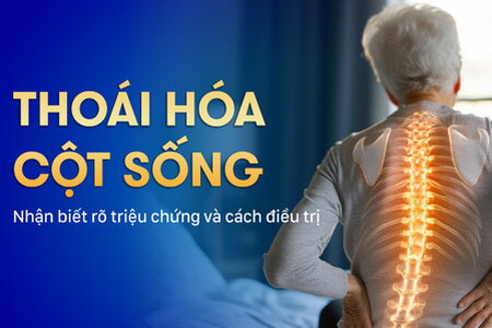 Thoái hóa cột sống: Nhận biết rõ triệu chứng và cách điều trị