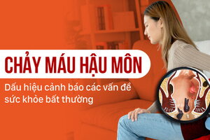 Chảy máu hậu môn: Dấu hiệu cảnh báo các vấn đề sức khỏe bất thường