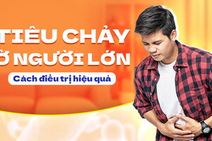 Chỉ dẫn cách điều trị tiêu chảy ở người lớn hiệu quả nhanh