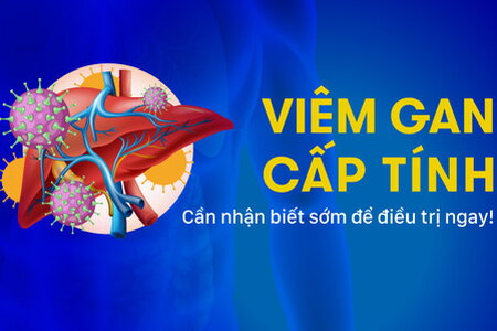 Viêm gan cấp tính: Cần nhận biết sớm để điều trị ngay!