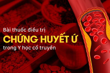 Bài thuốc điều trị chứng huyết ứ trong Y học cổ truyền