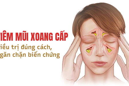 Viêm mũi xoang cấp: Điều trị đúng cách, ngăn chặn biến chứng