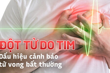 Đột tử do tim: Dấu hiệu cảnh báo tử vong bất thường ở người khỏe mạnh