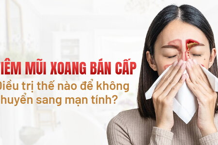 Viêm mũi xoang bán cấp: Điều trị sao để không chuyển sang mạn tính?