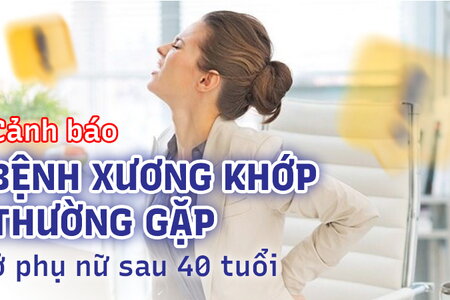 Cảnh báo bệnh xương khớp thường gặp ở phụ nữ sau 40 tuổi