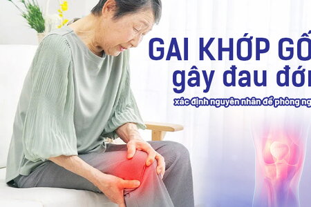 Gai khớp gối gây đau đớn: Cần xác định nguyên nhân để phòng ngừa