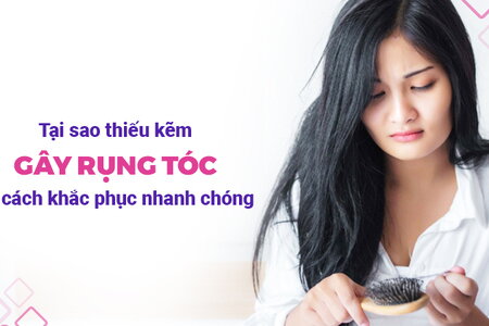 Tại sao thiếu kẽm gây rụng tóc và cách khắc phục nhanh chóng