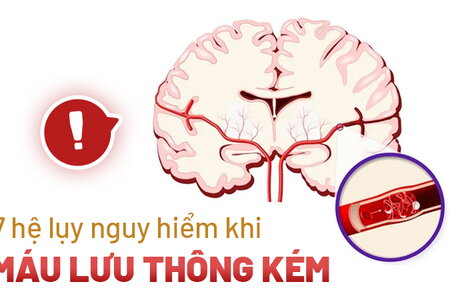 7 hệ lụy nguy hiểm khi máu lưu thông kém