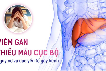 Viêm gan thiếu máu cục bộ: Nguy cơ và các yếu tố gây bệnh