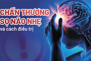 Nhận biết triệu chứng chấn thương sọ não nhẹ và cách điều trị