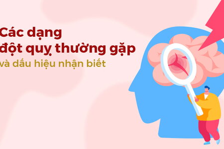 Các dạng đột quỵ thường gặp và dấu hiệu nhận biết đột quỵ