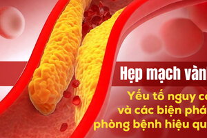 Hẹp mạch vành: Yếu tố nguy cơ và các biện pháp phòng bệnh hiệu quả