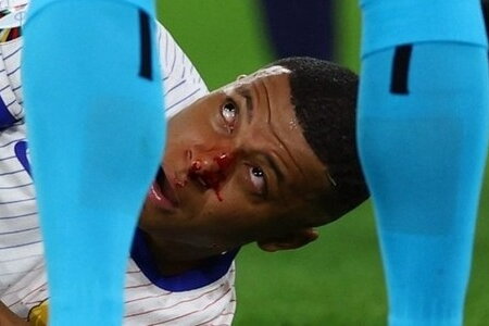 Chùm ảnh: Mbappe gãy xương mũi, phải đeo mặt nạ ở EURO 2024