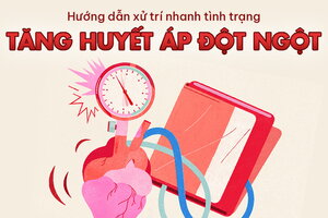 Hướng dẫn xử trí nhanh tình trạng tăng huyết áp đột ngột