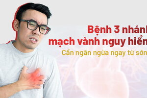 Bệnh 3 nhánh mạch vành nguy hiểm: cần ngăn ngừa ngay từ sớm!