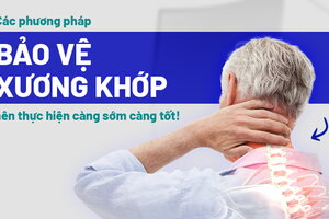 Các phương pháp bảo vệ xương khớp nên thực hiện càng sớm càng tốt!