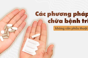 Các phương pháp chữa bệnh trĩ không cần phẫu thuật