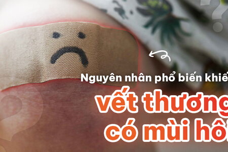 Những nguyên nhân phổ biến khiến vết thương có mùi hôi