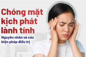Chóng mặt kịch phát lành tính: Nguyên nhân và các biện pháp điều trị