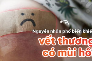 Những nguyên nhân phổ biến khiến vết thương có mùi hôi