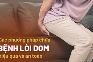 Các phương pháp chữa bệnh lòi dom hiệu quả và an toàn