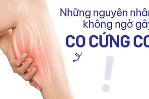 Những nguyên nhân không ngờ gây co cứng cơ