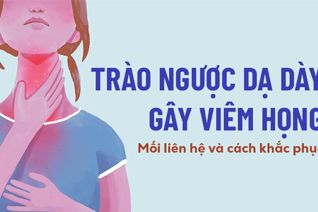 Trào ngược dạ dày gây viêm họng: Mối liên hệ và cách khắc phục