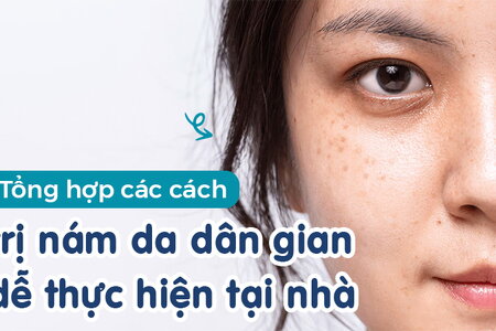 Tổng hợp các cách trị nám da dân gian dễ thực hiện tại nhà