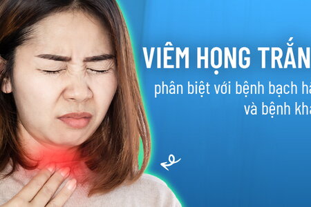 Viêm họng trắng – phân biệt với bệnh bạch hầu và bệnh khác