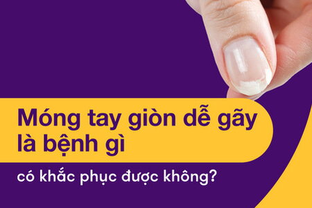 Giải đáp: Móng tay giòn dễ gãy là bệnh gì, có khắc phục được không?