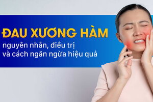 Đau xương hàm: Nguyên nhân, điều trị và cách ngăn ngừa hiệu quả