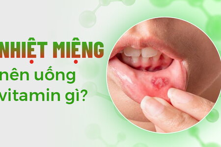 Tư vấn: Nhiệt miệng nên uống vitamin gì?