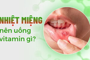 Tư vấn: Nhiệt miệng nên uống vitamin gì?
