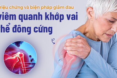 Các triệu chứng, biện pháp giảm đau viêm quanh khớp vai thể đông cứng