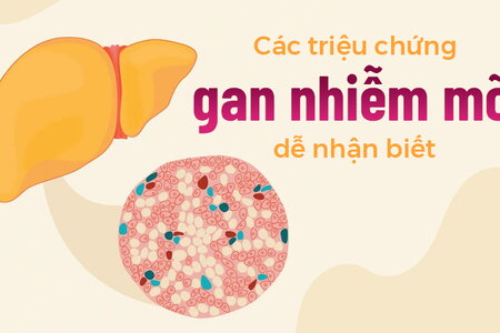 Các triệu chứng gan nhiễm mỡ dễ nhận biết