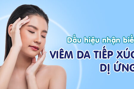 Dấu hiệu nhận biết viêm da tiếp xúc dị ứng phổ biến nhất