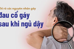 Chỉ rõ các nguyên nhân gây đau cổ gáy sau khi ngủ dậy