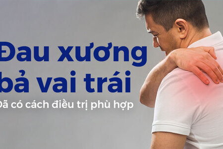 Đau xương bả vai trái: Đã có cách điều trị phù hợp