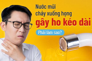 Nước mũi chảy xuống họng gây ho kéo dài: Phải làm sao?