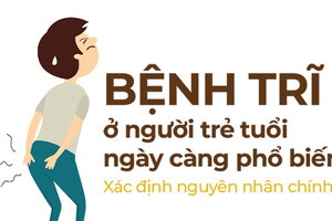 Bệnh trĩ ở người trẻ tuổi ngày càng phổ biến: xác định nguyên nhân