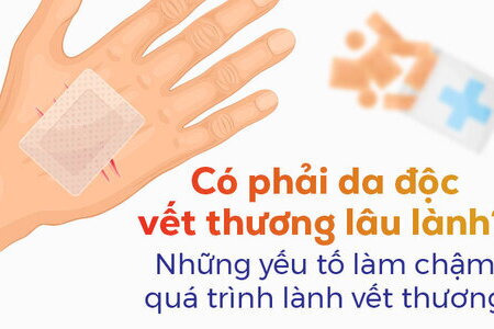 Có phải da độc vết thương lâu lành? Những yếu tố làm chậm